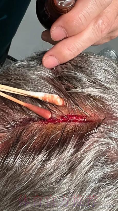 安帅曾表示希望球员健康归来 但皇马已有5人受伤